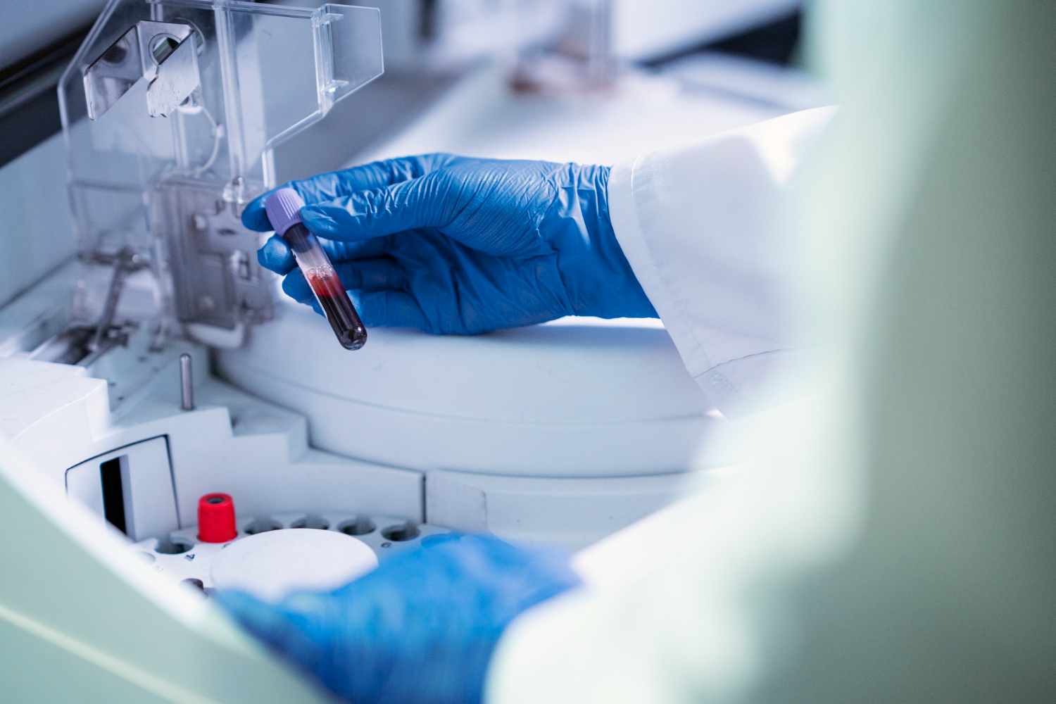 Da li znate da 70% odluka o terapiji ljekara zavisi upravo od laboratorijskih nalaza?